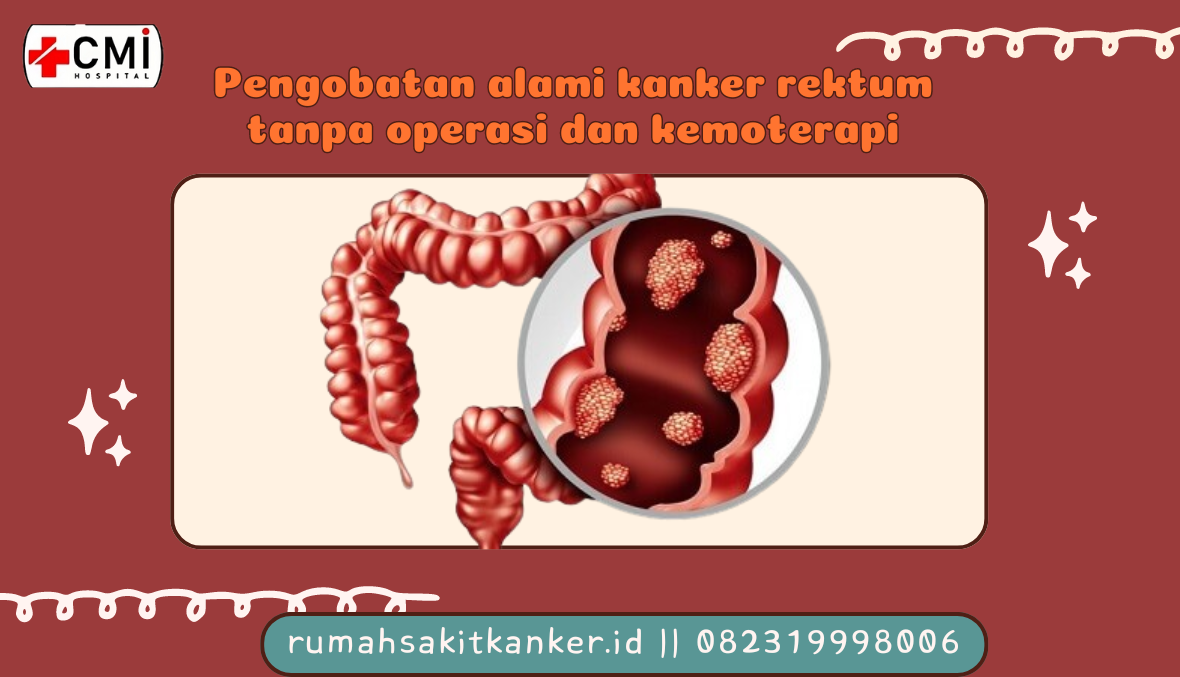 Pengobatan_alami_kanker_rektum_tanpa_operasi_dan_kemoterapi_(1).png